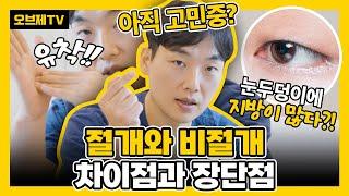 절개와 비절개, 차이점과 장단점 확실하게 알려드리겠습니다! 진짜 완전 쉬워요! | 눈수술 눈성형 절개 비절개 오브제성형외과 이경묵 원장