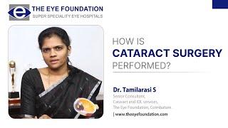 How Cataract Surgery Performed | Cataract Treatment  | The Eye Foundation #cataracttreatment