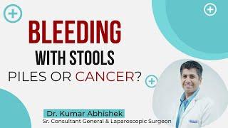 Bleeding with Stools - Piles or Cancer| Deptt. of General & Laparoscopic Surgery | Healing Hospital