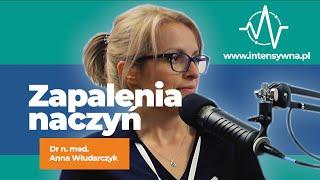 Zapalenia naczyń - co musi wiedzieć personel oddziału intensywnej terapii? | Dr Anna Włudarczyk