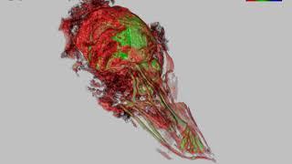 Digital Video Library of Asian Citrus Psyllid, Diaphorina citri: 5 (Abdominal tip and Spermatheca)