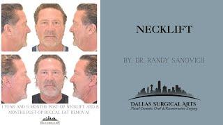 A Look Inside The OR: Necklift at Dallas Surgical Arts