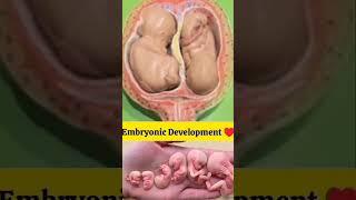 twins baby movement #baby #movement