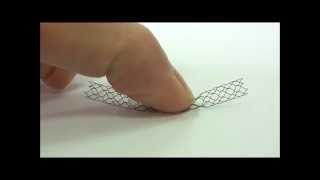 Nitinol stent - elastic memory