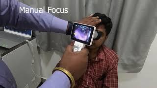 KODYMEDICAL HORUS FUNDUS CAMERA MODEL DEC 200