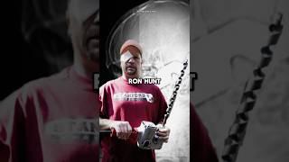 Kelapa Pria Ini Tertumsuk Mata Bor Tapi Masih Sadar : Ron Hunt #lethologicaman