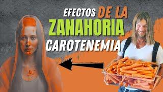 Efectos de la Zanahoria  ¿Te pones color naranja? Dr. Ludwig Johnson