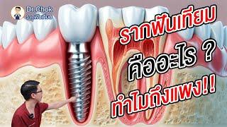 รากฟันเทียม คืออะไร ? ทำไมถึงแพง ?!! | คลายปัญหารากฟันเทียมกับหมอโชค