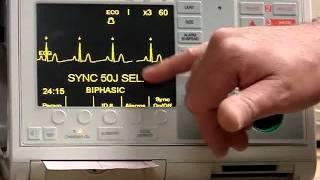 Zoll Defib PM Procedures