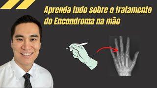 Treatment of enchondroma in the hand