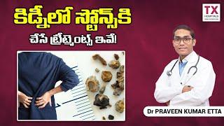 Treatment for Kidney Stones: Surgical and Medical Treatment Options Explained || TX Hospitals