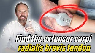 ECRB Scanning Tips for Tennis Elbow - SMUG MSKUS