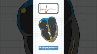 Kurven des EKGs in 60 Sekunden erklärt  #medizinstudium #ekg #medizin