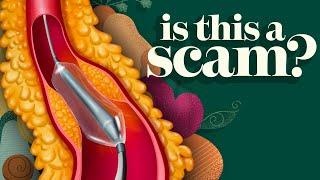 Is Angioplasty a Scam? The Terrifying Truth | Dr. McDougall Health & Medical Center