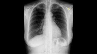 RADS.110  Anatomy of the Thoracic Viscera