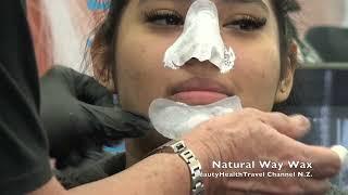 Blackhead Removal from Nose and Chin