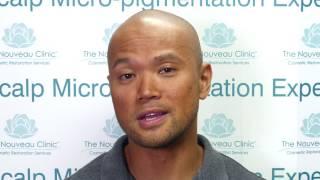 Scalp Micro-pigmentation Testimonial from The Nouveau Clinic