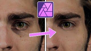 Augenringe entfernen | Affinity Photo 2 Tutorial