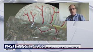 Stroke Risk RIsing in Young People