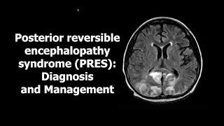 Posterior reversible encephalopathy syndrome