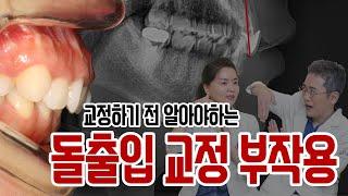 치과의사가 알려주는 돌출입교정 부작용 및 예방법(옥니,옹니,합죽이)