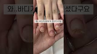 물어뜯는손톱 연장 후기 #아크릴네일 #아크릴연장 #물어뜯는손톱