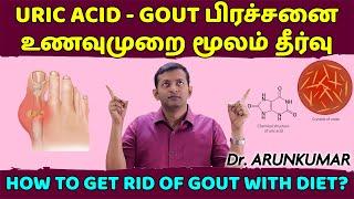 Diet plan for uric acid – gout problem | how to get rid of gout naturally? | Dr. Arunkumar