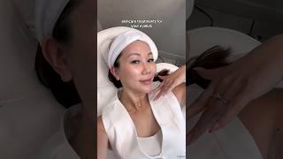 Skincare Treatment: Sylfirm X review &  Minivlog #dayinmylife #cosmetictreatment