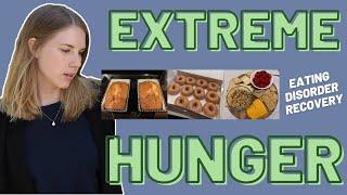 Dealing with EXTREME HUNGER in Eating Disorder Recovery