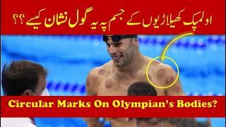 Cupping Therapy | Hijama in Olympics | Olympics Champions Secret | Best Remedy for Pain & Relaxation