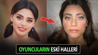 DİZİ OYUNCULARININ ÇOK ŞAŞIRTAN ESKİ HALLERİ