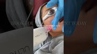 Lutronic Ultra-Satisfying