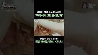 발톱이 이별 통보를... "우리 이제 그만 붙어있자^^"  #레푸스 #일산레푸스 #내성발톱 #무좀발톱 #ingrown_toenail #일산내성발톱 #일산무좀발톱 #발톱