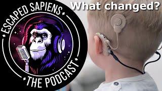 How much have hearing aids improved in 30 years? | Gregg Suaning | Escaped Sapiens Podcast