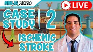 Case Study #2: Ischemic Stroke