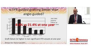 Fractional Flow Reserve and Cardiac Surgery