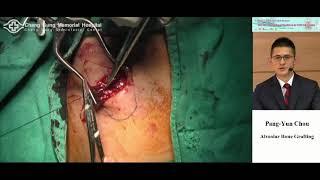 20201108 014 Alveolar Bone Grafting  Pang Yun Chou MD