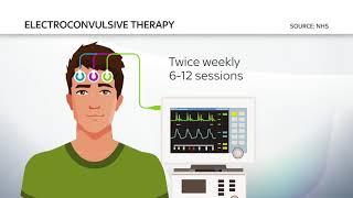 The Dangers of Electroconvulsive Therapy (Sky News Report)