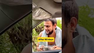 Round 2 hell fame YouTuber Mehtab saifi Hair Transplant Progress #shorts #69 #hairstyle