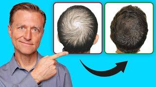 How to Help Regrow Your Hair (UPDATED VITAL INFO)