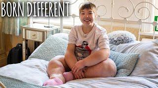 The Teen With The Swollen Body | BORN DIFFERENT