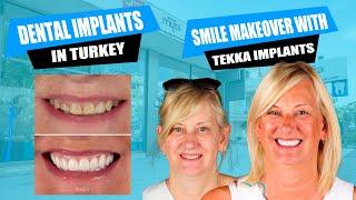 Dental Implants in Turkey