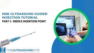 Part 1: Ultrasound guided injection tutorial: Needle insertion point