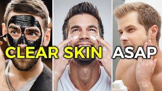 How to Get Clear Skin for Guys ASAP