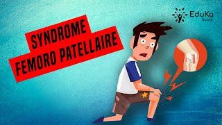 SOIGNER LE SYNDROME FEMORO PATELLAIRE [Syndrome rotulien]