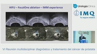 Dr. Rafael Sánchez Salas | Terapia focal del cáncer de próstata localizado. Posición de la EUA.