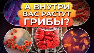 Признаки патогенной микрофлоры / Как понять, что нарушена микрофлора ЖКТ