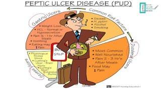 Pharmacology of Peptic Ulcer Disease