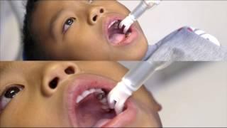 DentalVibe Instructional Video for Pediatric Dentists