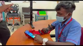 FUNCTIONAL REHABILITATION WITH ADVANCED 3D PRINTED ELBOW DRIVEN PROSTHESIS -Sri Ramachandra Hospital